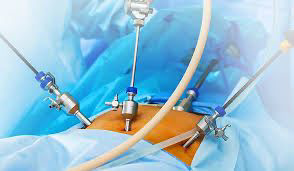 כירורגיה גניקולוגית